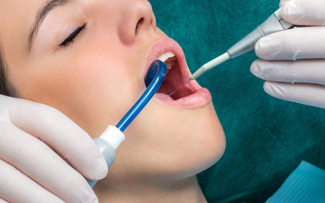 Igiene dentale professionale: in cosa consiste la pulizia dei denti fatta dal dentista o dall’ igienista dentale 