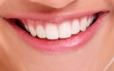 Sbiancamento denti fai-da-te: attenzione ai rimedi non professionali